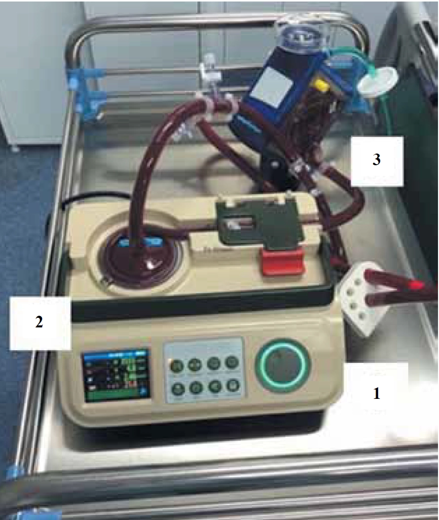 Вид перфузионного&nbsp; контура для ЭКМО донора: 1 -аппарат "Ex-Stream"; 2 – центрифужная головка; 3 - оксигенатор и артериальный фильтр 